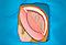 Operate Now: Epilepsy Surgery